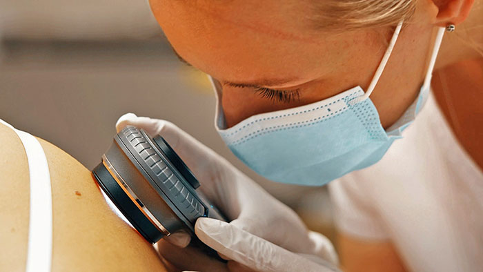 Dermatologist performs spot check